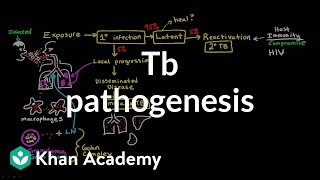 TB pathogenesis  Infectious diseases  NCLEXRN  Khan Academy [upl. by Fahy]