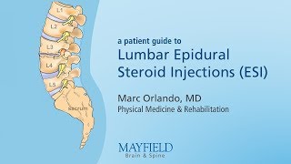 Lumbar Epidural Steroid Injections [upl. by Goto]