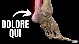 la CURA DEFINITIVA al Tendine DACHILLE infiammato METODO SCIENTIFICO [upl. by Azal]