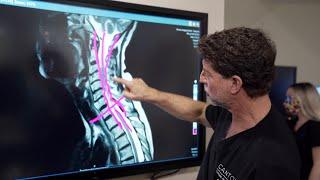 Symptoms of Cervical Stenosis  Jeffrey Cantor MD [upl. by Ahseile]