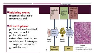 Leiomyoma uteri [upl. by Hacim]