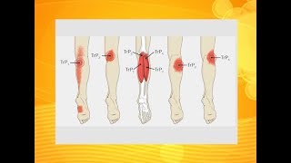 How to get instant relief from Leg Pain  Dr Hansaji Yogendra [upl. by Ahsienel690]