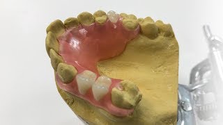 How To Make A Fiber Flex™ Partial  The Entire Process  Dental Lab Learning [upl. by Iretak900]