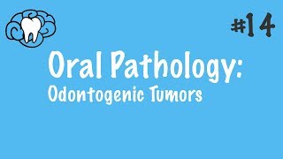 Oral Pathology  Odontogenic Tumors  INBDE ADAT [upl. by Phelps]