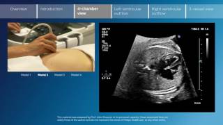 Key screening views of the fetal heart  Part 3  4chamber view [upl. by Elberta]