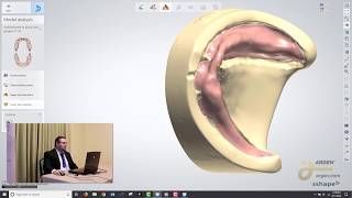 Digital Dentures A Crash Course on How to Design using 3Shape  Logan Woomer [upl. by Ardekahs]