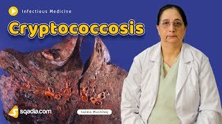 Cryptococcosis  Infectious Medicine Video Lectures  Medical Education  VLearning [upl. by Lachlan]