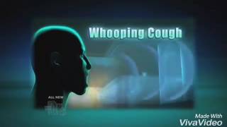 Different types of cough sounds [upl. by Dionisio]