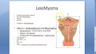 Method Used To Obtain Robotic Fibroids Tumor Removal  Robotic Myomectomy  Manipal Hospitals [upl. by Palestine]