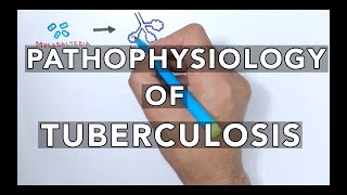 Pathophysiology of Tuberculosis [upl. by Nawk796]