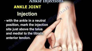 Common Foot And Ankle Injections  Everything You Need To Know  Dr Nabil Ebraheim [upl. by Saylor]