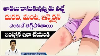 How to Treat Skin Fungal Infection  Candid Cream Benefits  Reduces Ringworm  DrRavikanth Kongara [upl. by Cirdec929]