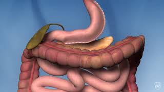 Sleeve Gastrectomy Operation [upl. by Aiciled]