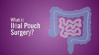 What is Ileal Pouch Surgery [upl. by Bernardina]