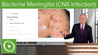 Bacterial Meningitis CNS Infection – Infectious Diseases  Lecturio [upl. by Vizzone802]