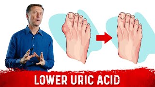 4 Ways to Neutralize Uric Acid [upl. by Nimar]