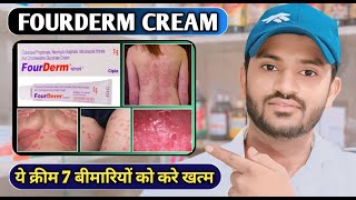 Fourderm cream uses in hindi and full review [upl. by Arramahs]