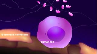 Orthopedic Oncology Course  Introduction to Musculoskeletal Tumors  Lecture 1 [upl. by Sucramed]