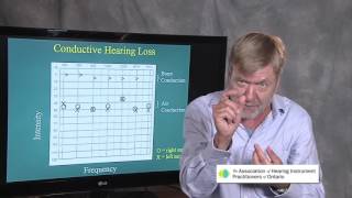 Ted Venema Talks Reading the Audiogram [upl. by Acinoda]