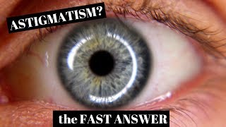 Astigmatism Explained in One Minute [upl. by Laicram484]