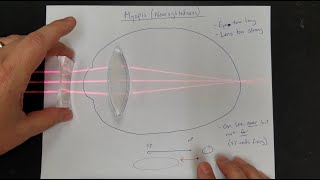 Vision Correction Normal Eyes Myopia Hyperopia Near amp Far Point Lens Power [upl. by Kcerred]