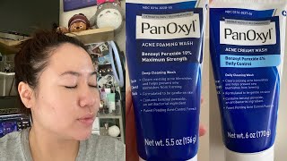 PanOxyl 10 vs 4 Acne Foaming Wash  Which is better for your skin [upl. by Season]