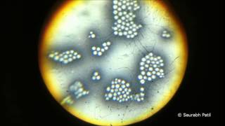 Cryptococcus neoformans with capsules [upl. by Oribella582]