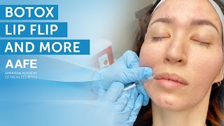 Botox Lip Flip Treatment  More  AAFE [upl. by Myrta682]