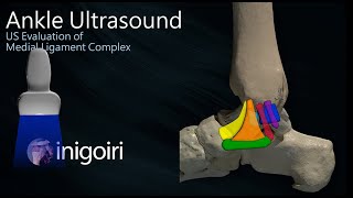 ANKLE ULTRASOUND MEDIAL LIGAMENT COMPLEX EVALUATION [upl. by Marijo]