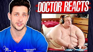 The Harsh Reality Of Being 800 Pounds  Doctor Reacts [upl. by Tterag]