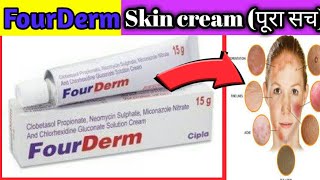 FourDerm skin protection cream review  antifungal redness eaching germsrases  SG Support [upl. by Koosis593]