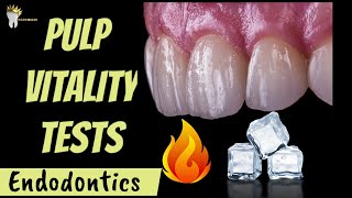 ENDODONTICS  PULP VITALITY TESTS MADE EASY [upl. by Tobe]