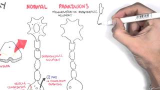 Pharmacology  Parkinsons Disease [upl. by Lunette562]