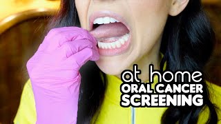 How To Screen For Oral Cancer At Home [upl. by Akemad812]