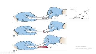 Preparation of peripheral blood smear [upl. by Reedy236]