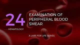 Part 2  Examination of Peripheral Blood Smear [upl. by Enailil]