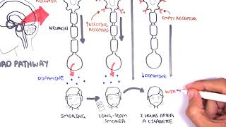 How NRT works [upl. by Moises]