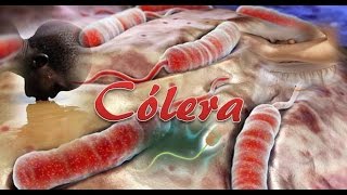 Cólera Vibrio cholerae [upl. by Nivlak]