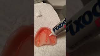 Denture adhesive how to video [upl. by Alroy745]