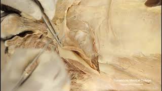 Part3 Inguinal canal [upl. by Jaddan]