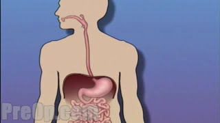 Esophagogastroduodenoscopy [upl. by Larrie]