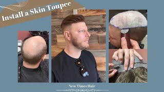 How to Install a Skin Toupee Mens hair system before and after  NEW TIMES HAIR [upl. by Sirej858]