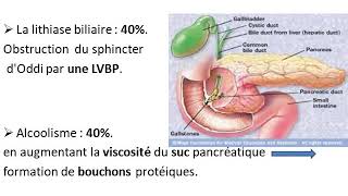 pancreatite aigue Dr Bensetti [upl. by Ok]