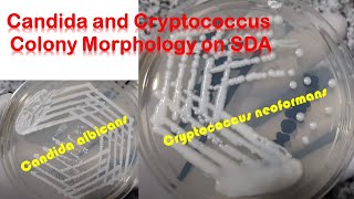 Candida and Cryptococcus colony morphology on SDA [upl. by Aleen]