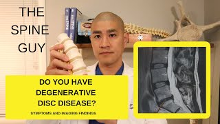 Lumbar Degenerative Disc Disease Part 1 Symptoms and Imaging [upl. by Etteniotna]