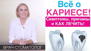 Кариес  симптомы лечение кариеса причины появления Как лечить кариес без сверления [upl. by Adirahs]