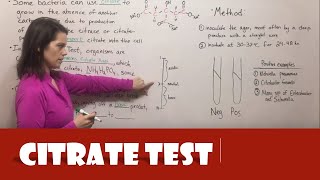 Citrate Test [upl. by Nahtanha771]