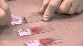 IDEXX  How to make a Blood Film in 3 steps [upl. by Daile]