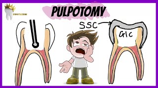 PEDIATRIC DENTISTRY  PULPOTOMY  Types Indications Procedure [upl. by Laon]