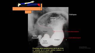 SERIE ESOFAGOGASTRODUODENAL ANATOMIA FUNCION Y REALIZACION [upl. by Alexei]